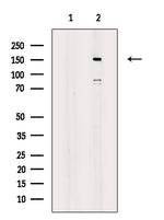 Phospho-IGF1R (Tyr980) Antibody in Western Blot (WB)