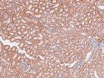 Phospho-A-Raf (Ser299) Antibody in Immunohistochemistry (Paraffin) (IHC (P))