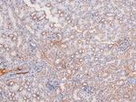 Phospho-BRK (Tyr342) Antibody in Immunohistochemistry (Paraffin) (IHC (P))