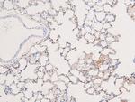 Phospho-BRK (Tyr342) Antibody in Immunohistochemistry (Paraffin) (IHC (P))