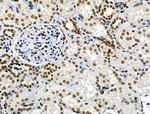 Phospho-CAMKK alpha/beta (Ser458, Ser495) Antibody in Immunohistochemistry (Paraffin) (IHC (P))