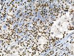 Phospho-CAMKK alpha/beta (Ser458, Ser495) Antibody in Immunohistochemistry (Paraffin) (IHC (P))