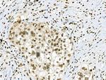 Phospho-CAMKK alpha/beta (Ser458, Ser495) Antibody in Immunohistochemistry (Paraffin) (IHC (P))