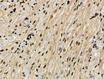 Phospho-CAMKK alpha/beta (Ser458, Ser495) Antibody in Immunohistochemistry (Paraffin) (IHC (P))