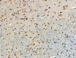 Phospho-CAMKK alpha/beta (Ser458, Ser495) Antibody in Immunohistochemistry (Paraffin) (IHC (P))