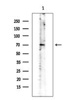 Phospho-CAMKK alpha/beta (Ser458, Ser495) Antibody in Western Blot (WB)