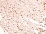 Phospho-CSK (Tyr304) Antibody in Immunohistochemistry (Paraffin) (IHC (P))