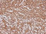 Phospho-CSK (Tyr304) Antibody in Immunohistochemistry (Paraffin) (IHC (P))