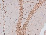 Phospho-CSK (Tyr304) Antibody in Immunohistochemistry (Paraffin) (IHC (P))