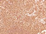 Phospho-CSK (Tyr304) Antibody in Immunohistochemistry (Paraffin) (IHC (P))