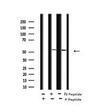 Phospho-CSK (Tyr304) Antibody in Western Blot (WB)