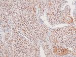 Phospho-DAPK1 (Ser734) Antibody in Immunohistochemistry (Paraffin) (IHC (P))