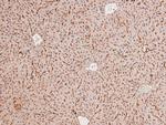 Phospho-DAPK1 (Ser734) Antibody in Immunohistochemistry (Paraffin) (IHC (P))