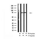 Phospho-DYRK1A/DYRK1B (Tyr321, Tyr273) Antibody in Western Blot (WB)