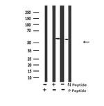 Phospho-DYRK2/DYRK4 (Tyr382, Tyr264) Antibody in Western Blot (WB)