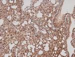 Phospho-FER (Tyr714) Antibody in Immunohistochemistry (Paraffin) (IHC (P))