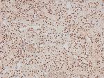 Phospho-FER (Tyr714) Antibody in Immunohistochemistry (Paraffin) (IHC (P))