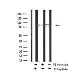 Phospho-FER (Tyr714) Antibody in Western Blot (WB)