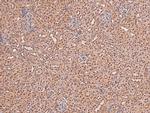 Phospho-FGFR2 (Tyr769) Antibody in Immunohistochemistry (Paraffin) (IHC (P))