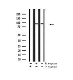 Phospho-FGFR3 (Tyr760) Antibody in Western Blot (WB)