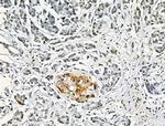 Phospho-FGFR4 (Tyr754) Antibody in Immunohistochemistry (Paraffin) (IHC (P))