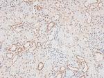 Phospho-FGR (Tyr412) Antibody in Immunohistochemistry (Paraffin) (IHC (P))