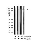 Phospho-GCN2 (Thr899) Antibody in Western Blot (WB)