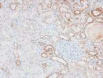 Phospho-IKK epsilon (Ser172) Antibody in Immunohistochemistry (Paraffin) (IHC (P))