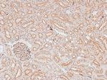 Phospho-IKK epsilon (Ser172) Antibody in Immunohistochemistry (Paraffin) (IHC (P))