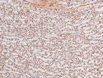 Phospho-JAK3 (Tyr904) Antibody in Immunohistochemistry (Paraffin) (IHC (P))