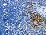 Phospho-JAK3 (Tyr981) Antibody in Immunohistochemistry (Paraffin) (IHC (P))