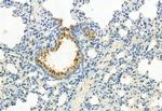 Phospho-JAK3 (Tyr981) Antibody in Immunohistochemistry (Paraffin) (IHC (P))