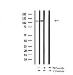 Phospho-JAK3 (Tyr981) Antibody in Western Blot (WB)