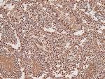 Phospho-LATS1/LATS2 (Ser909, Ser872) Antibody in Immunohistochemistry (Paraffin) (IHC (P))