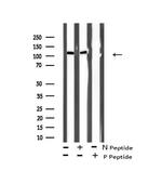 Phospho-LATS1/LATS2 (Ser909, Ser872) Antibody in Western Blot (WB)