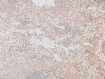 Phospho-MKNK2 (Thr249) Antibody in Immunohistochemistry (Paraffin) (IHC (P))