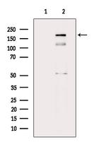 Phospho-PDGFRb (Tyr857) Antibody in Western Blot (WB)