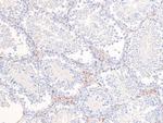 Phospho-PDGFRb (Tyr857) Antibody in Immunohistochemistry (Paraffin) (IHC (P))