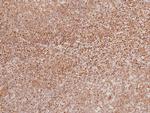 Phospho-TBK1 (Ser172) Antibody in Immunohistochemistry (Paraffin) (IHC (P))