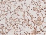 Phospho-TBK1 (Ser172) Antibody in Immunohistochemistry (Paraffin) (IHC (P))