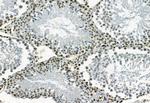 Phospho-TBK1 (Ser172) Antibody in Immunohistochemistry (Paraffin) (IHC (P))