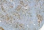 Phospho-TBK1 (Ser172) Antibody in Immunohistochemistry (Paraffin) (IHC (P))