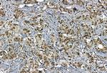 Phospho-TBK1 (Ser172) Antibody in Immunohistochemistry (Paraffin) (IHC (P))