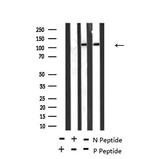 Phospho-TEK (Ser1119) Antibody in Western Blot (WB)