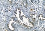 Phospho-FRS2 (Tyr196) Antibody in Immunohistochemistry (Paraffin) (IHC (P))