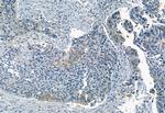 Phospho-FRS2 (Tyr196) Antibody in Immunohistochemistry (Paraffin) (IHC (P))