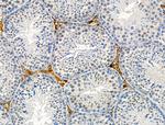 Phospho-Androgen Receptor (Ser83) Antibody in Immunohistochemistry (Paraffin) (IHC (P))