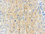 Phospho-Androgen Receptor (Ser83) Antibody in Immunohistochemistry (Paraffin) (IHC (P))