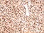 Phospho-RET (Tyr1015) Antibody in Immunohistochemistry (Paraffin) (IHC (P))