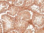 Phospho-RET (Tyr1015) Antibody in Immunohistochemistry (Paraffin) (IHC (P))